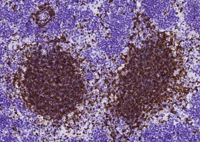 Recombinant CD79B/Ig-beta Monoclonal Antibody-searchlist-1