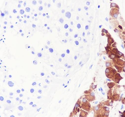 Recombinant INSL3 Monoclonal Antibody-searchlist-1