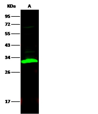 Recombinant Carbonic Anhydrase II/CA2 Monoclonal Antibody - small - 2