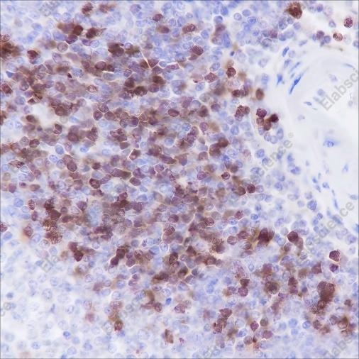 Recombinant TCL1 Monoclonal Antibody - 2