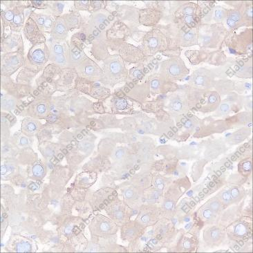 Recombinant FASN Monoclonal Antibody - 4