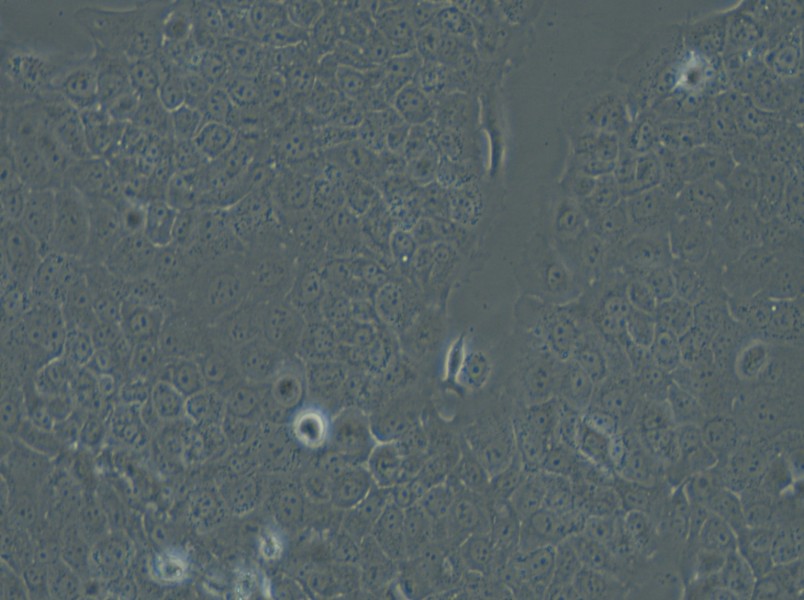 Ca Ski Cell Complete Medium - small - 4