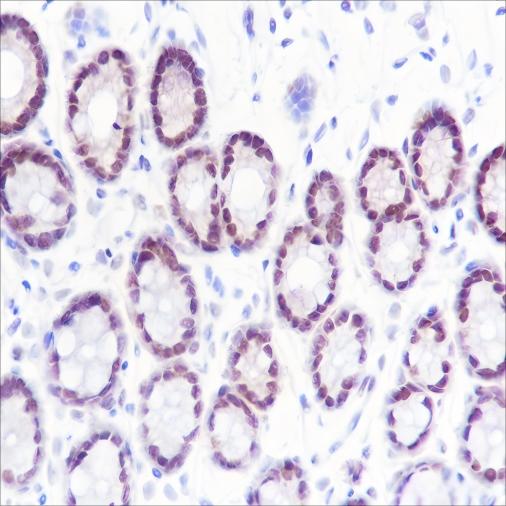 Recombinant SETD1A Monoclonal Antibody - small - 3