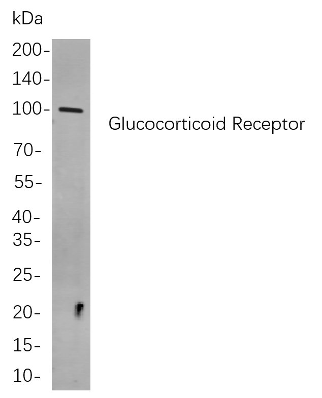 Recombinant Glucocorticoid Receptor Monoclonal Antibody-searchlist-1