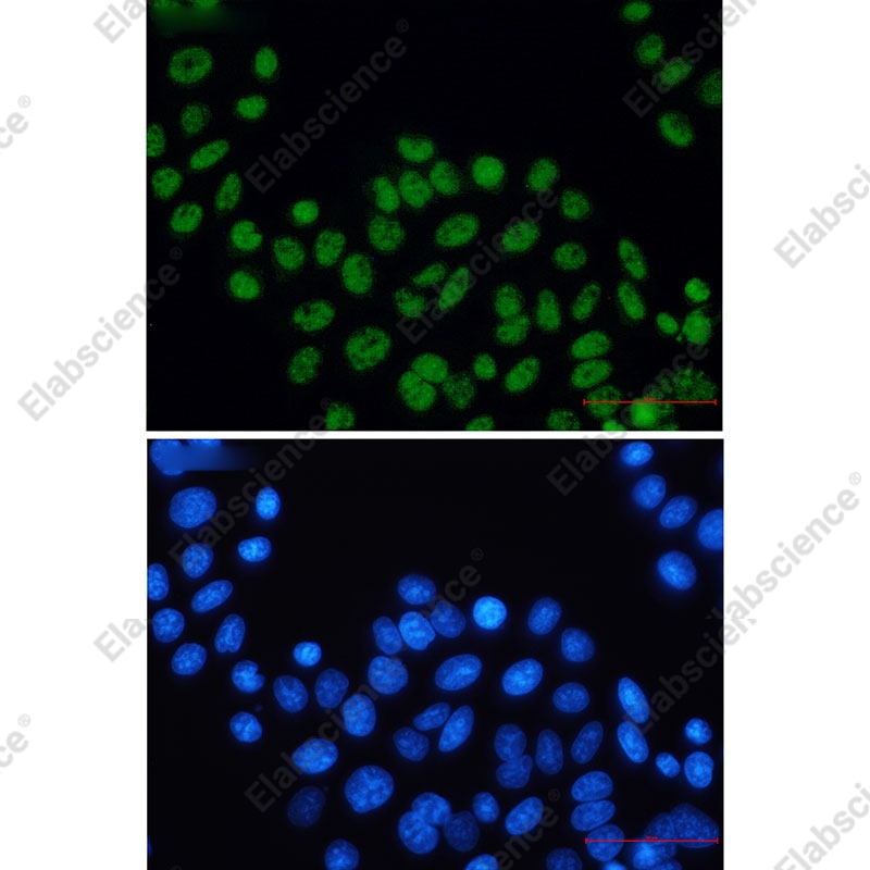 Recombinant XPD Monoclonal Antibody - 2