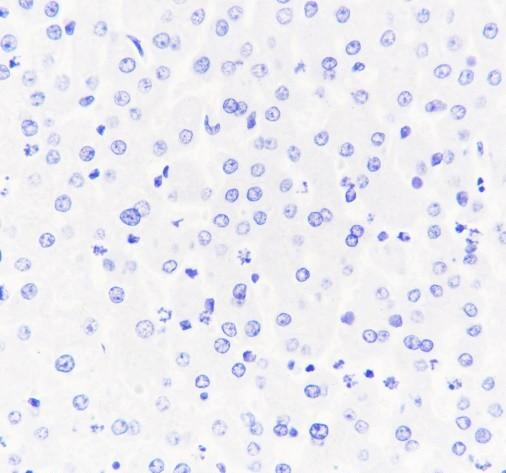 Recombinant INSL3 Monoclonal Antibody - 2