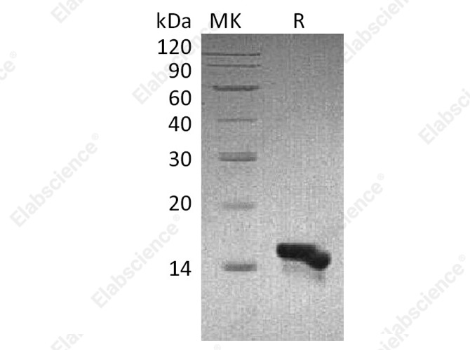 Recombinant Human CCL28 Protein - 1