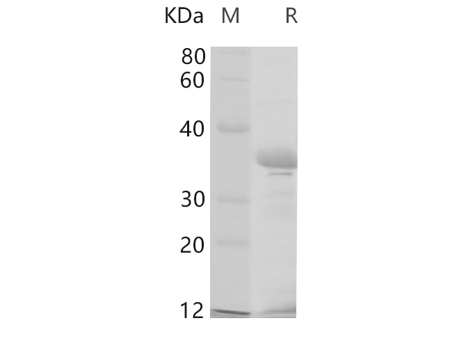 Recombinant Human G-CSF/CSF3 Protein-产品推荐-1