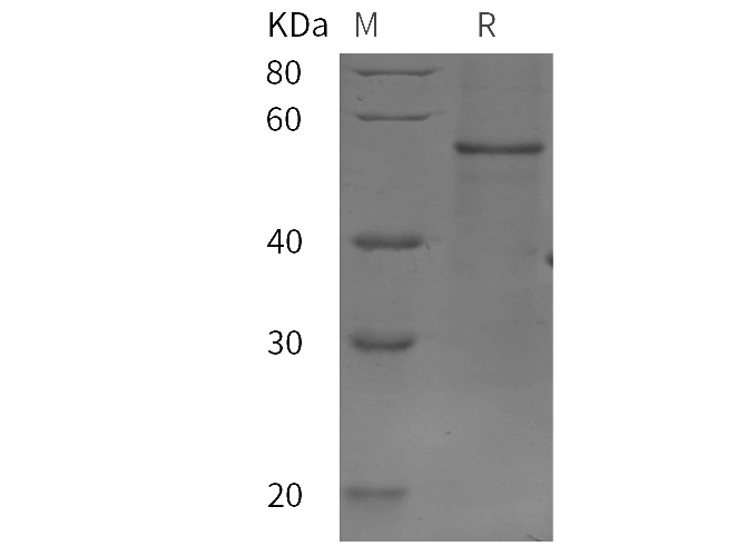 Recombinant Human IL17D Protein(Sumo Tag)-产品推荐-1