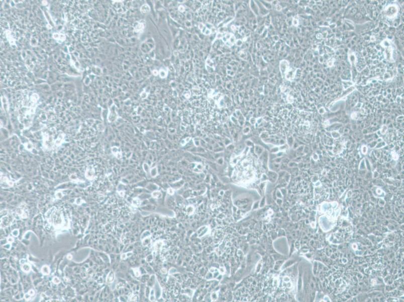 NCI-H1793 Cell Complete Medium - 3