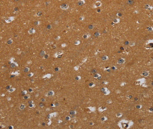 CSH1 Polyclonal Antibody - 2