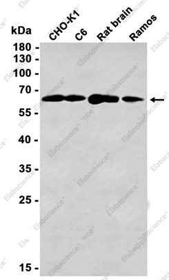Recombinant Pyruvate Dehydrogenase E2 Monoclonal Antibody - 1