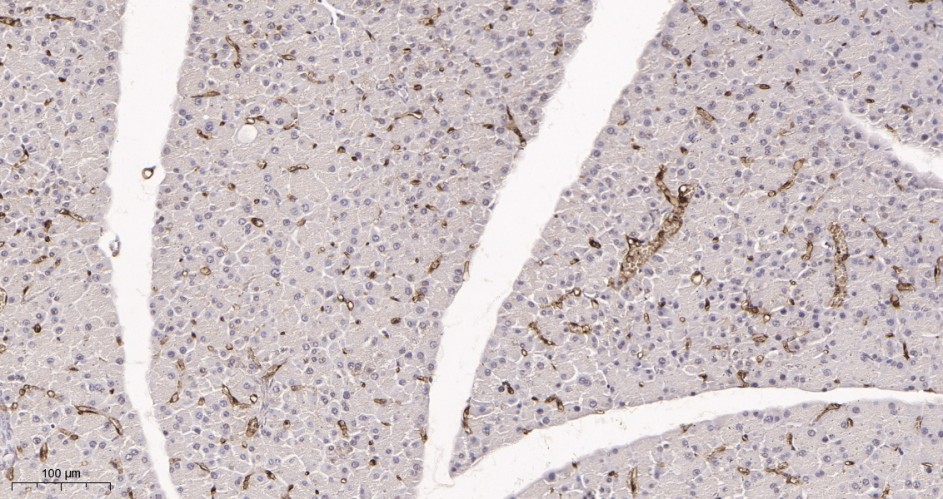 Recombinant FABP4 Monoclonal Antibody - small - 3