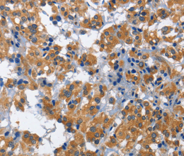 HSF27 Polyclonal Antibody - 2