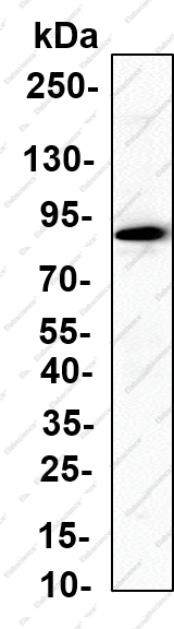 Recombinant PFK-B Monoclonal Antibody - 2