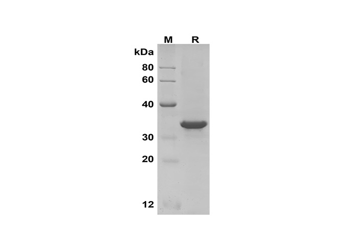 Recombinant Human PD1 Protein(His Tag)-1