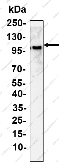 Recombinant MED15 Monoclonal Antibody - 1
