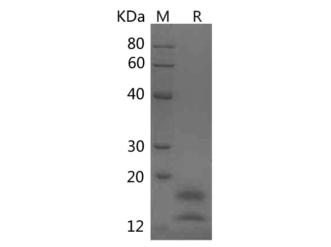 Recombinant Mouse GM-CSF Protein(His Tag)-产品推荐-1