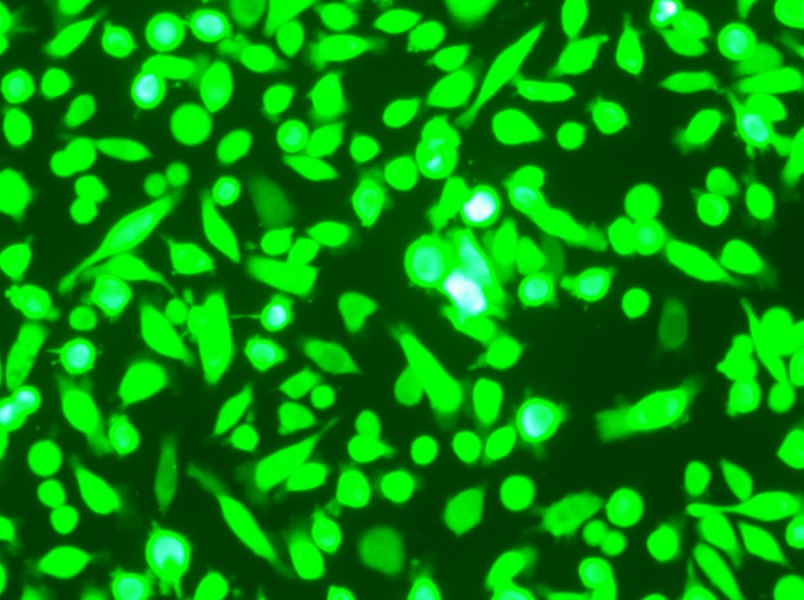 AGS-GFP Cell Complete Medium - 6
