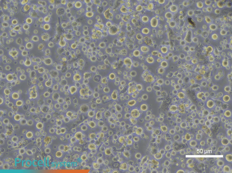 Human Peripheral Blood Maturation Dendritic cell Complete Medium - small - 6