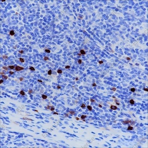 Recombinant CD1a Monoclonal Antibody - 4