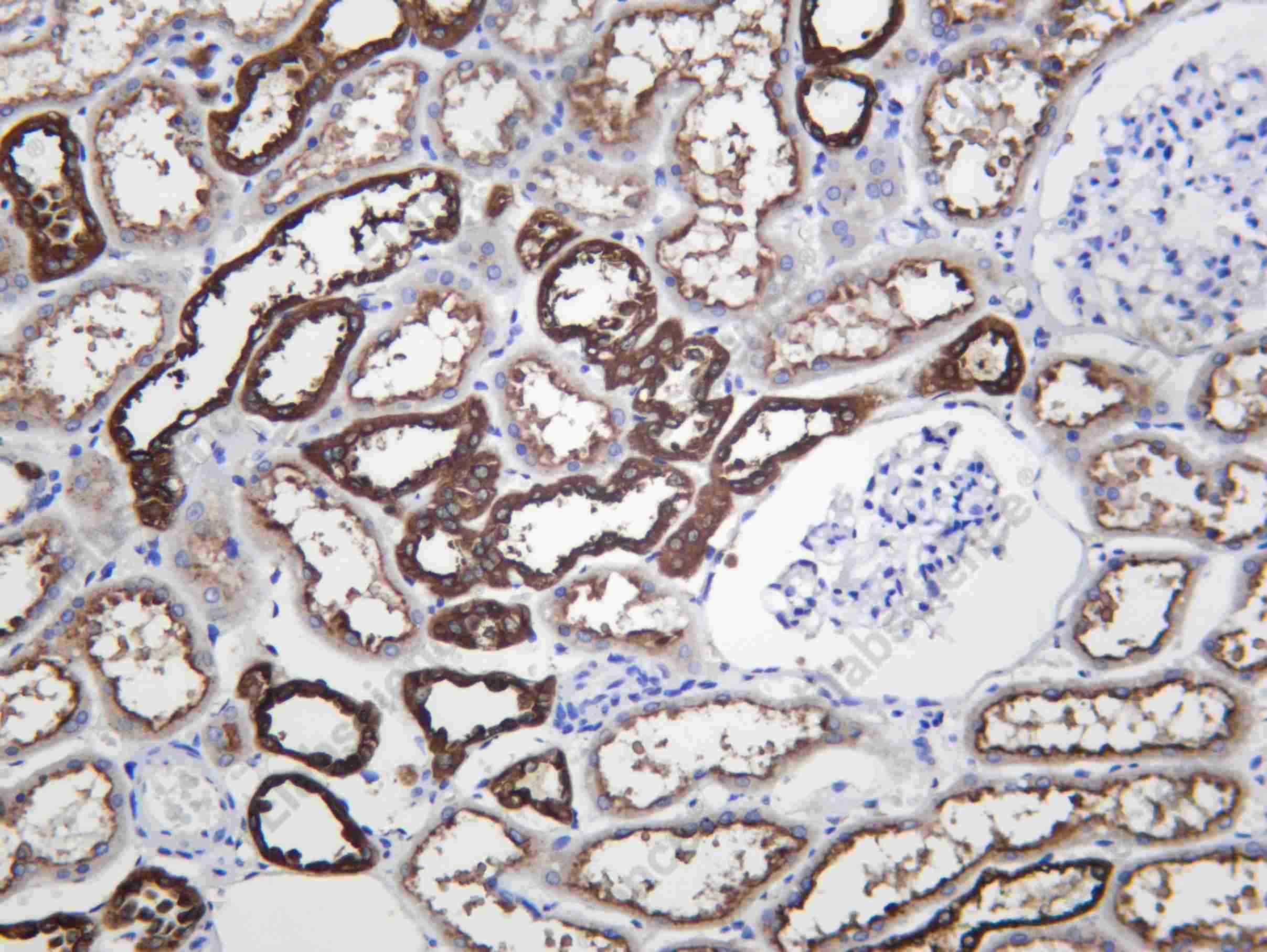 Recombinant V ATPase B1 Monoclonal Antibody - 1