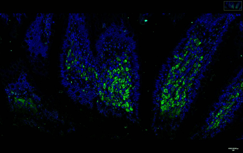 Recombinant TGF β1 Monoclonal Antibody - small - 8