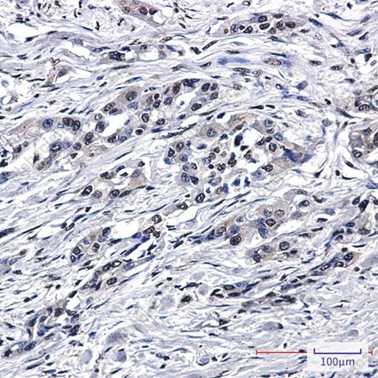 Recombinant PEN2 Monoclonal Antibody - 3