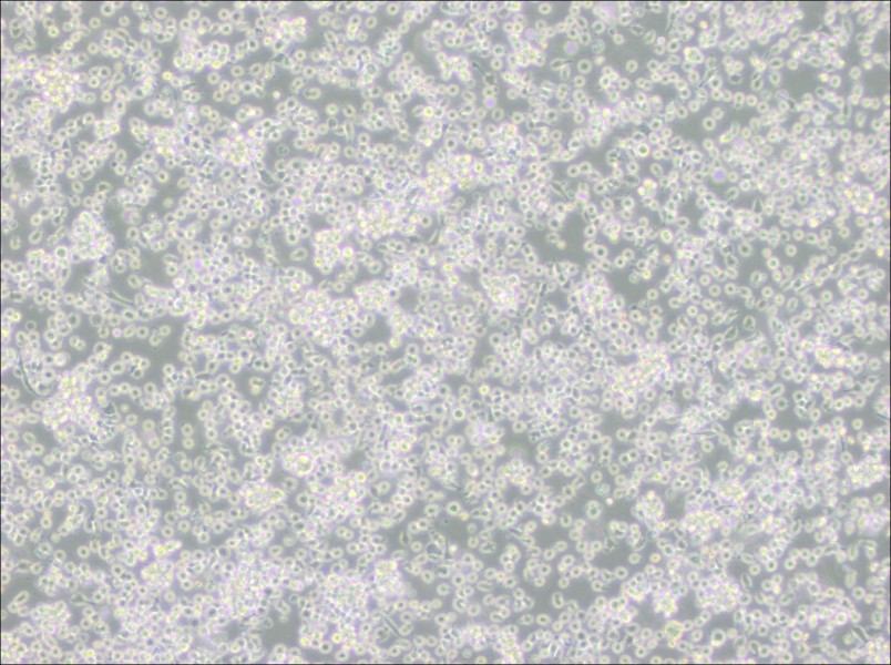 ARH-77 Cell Complete Medium - 3