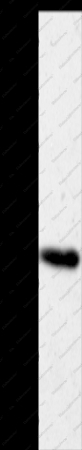 AKR1B1 Polyclonal Antibody - 1