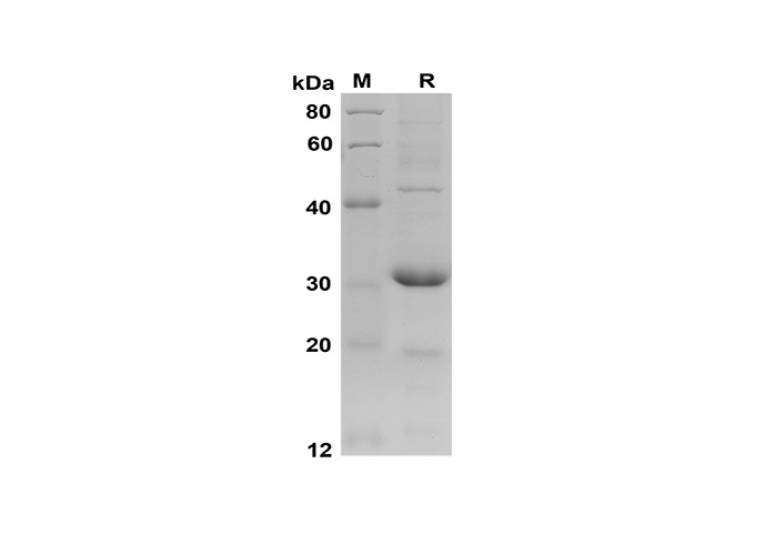 Recombinant Human TNF-α Protein(Gst Tag)-产品推荐-1