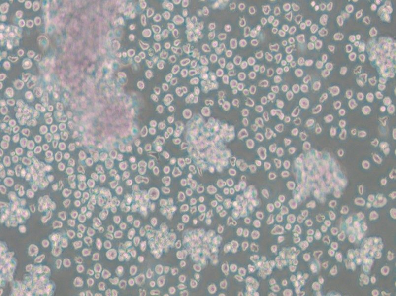 Granta-519 Cell Complete Medium - 4