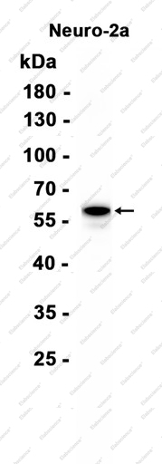 Recombinant Peripherin Monoclonal Antibody - 1