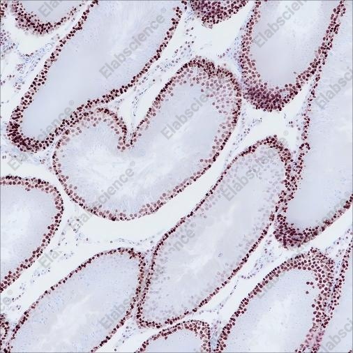 Recombinant MSH6 Monoclonal Antibody - 5