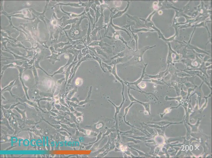 BT-20 Cell Complete Medium - small - 5