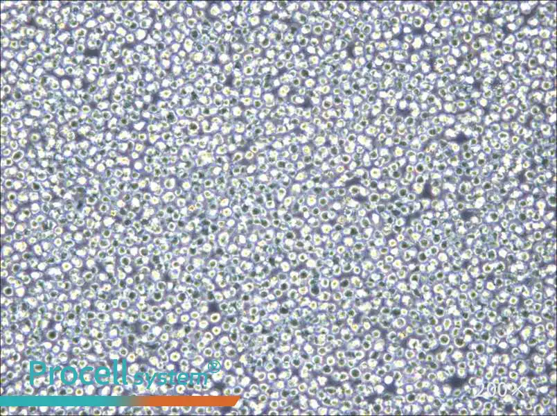 NOMO-1 Cell Complete Medium - 5