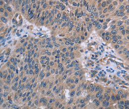 p53RFP Polyclonal Antibody - 2