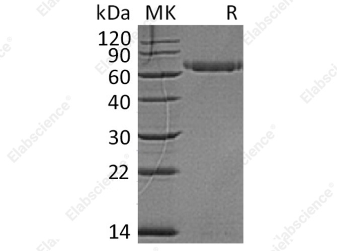 Recombinant Human LAG3/CD223 Protein (His Tag) - 1