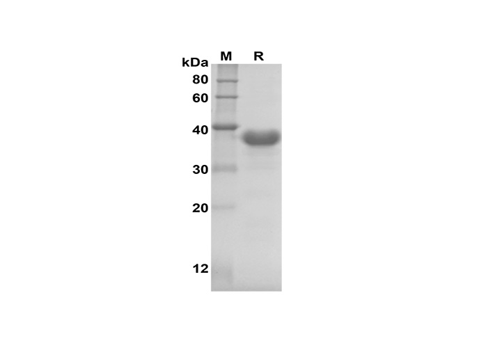 Recombinant Human IL-11 protein(Trx Tag)-1
