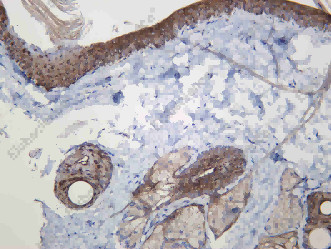 Recombinant 14 3 3σ Monoclonal Antibody - 3