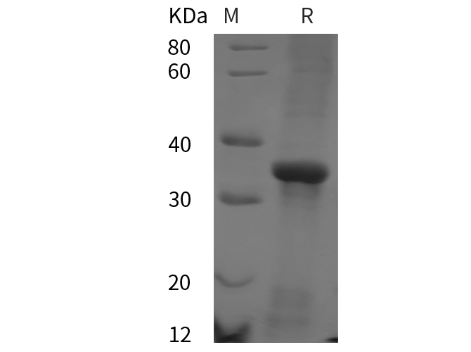 Recombinant Human CD38/SCARB3 Protein(His Tag)-1