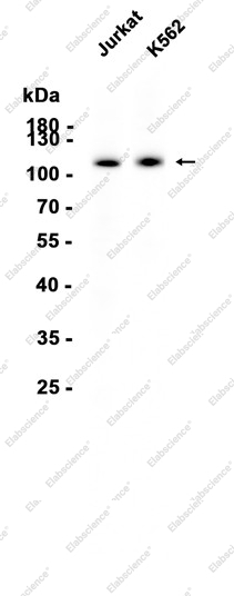 Recombinant UBA1 Monoclonal Antibody - 1