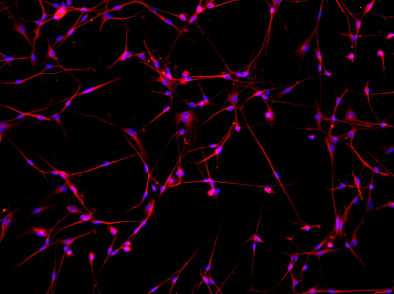Mouse Dorsal Root Neuron Complete Medium - 2