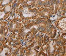 MTFR1 Polyclonal Antibody - 2