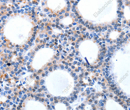 HCN1 Polyclonal Antibody - 2
