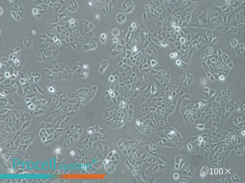 OVCAR-8 Cell Complete Medium - 1