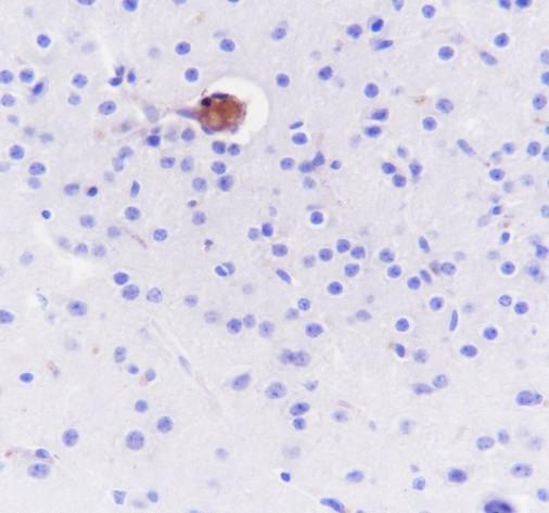 Recombinant Hemoglobin Alpha Monoclonal Antibody - small - 2
