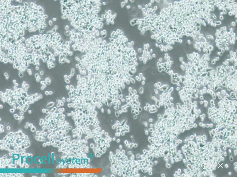 KMS-11 Cell Complete Medium - 1