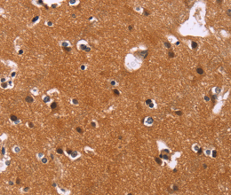 CBX3 Polyclonal Antibody - 3