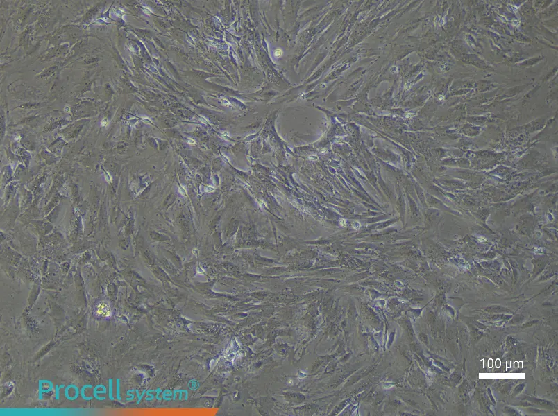 Mouse Bladder Smooth Muscle Cell Complete Medium - 3